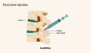 spine pain management - injection